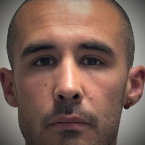 rinoplastia con cartílago costal 6