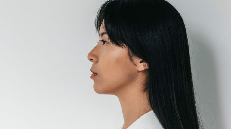 Rinoplastia secundaria en Bilbao: perfil con nariz natural y armónica